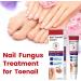 Fungal Nail Treatment Cream Antifungal Nail Polish Cream Nail Fungus Treatment for Toenail Strong Anti-Fungal Toenail Cream Nail Improve Cream Nail Repair Cream for Thick Cracked Discolored Nails - Buy Online on GoSupps.com
