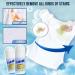 Emergency Stain Remover Roller-ball Cleaner Magic Stain Remover Rolling Bead Portable No-Wash Instant Stain Remover Pen Clothes Stain Remover-Roll Bead Design (1 PC) - Buy Online on GoSupps.com