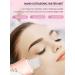 Skin Scrubber Blackhead Remover & Pore Cleaner | 3 Modes | USB Rechargeable - Pink - Buy Online on GoSupps.com
