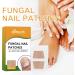Fungal Nail Treatment Nail Repair Patches Restores Damaged Nails Nail Fungus Treatment for Toenail Gently Effectively Nail Care Anti Fungal Repair Patches Restores Healthy Nails - Buy Online on GoSupps.com