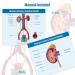 Life-Size Male Urinary System Anatomy Model - Detailed Bladder Kidneys Ureters & Adrenal Glands with Manual | Ideal for Medical Education & Study - Buy Online on GoSupps.com