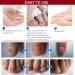 Fungal Nail Treatment for Toenail - Extra Strong Nail Repair Solution for Fingernails & Toenails - Safe & Effective Formula - 10 ml (Pack of 1) - Buy Online on GoSupps.com