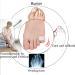 10 Pcs Pinky Toe Splint & Gel Toe Separators for Men & Women - Bunion Corrector & Relief - Buy Online on GoSupps.com