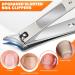 Heavy Duty Toenail Clippers for Seniors | Large Ingrown Nail Cutter with Long Handle & Wide Opening | Sharp Toenail Clippers for Thick Nails - Buy Online on GoSupps.com