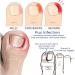 Ingrown Toenail Treatment Oil - Anti Paronychia Relief & Nail Growth Formula - Buy Online on GoSupps.com