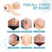 Buy Medical Grade Silicone Scar Sheets | Washable Scar Tape 1.6"x120" Roll - Ideal for Surgical Scars - Buy Online on GoSupps.com
