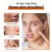Kojic Acid Soap Olive Oil Soap Kojic Acid Soap Original Olive Oil Soap Bar for Face And Body Acne Dark Spots Hyperpigmentation Smooth Skin Mens Soap Bar for Improve Uneven Skin Tone - Buy Online on GoSupps.com