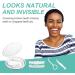 Buy 2 Pairs Snap-On Dentures for Women & Men - Veneers for Missing Teeth | Comfort & Confidence in Every Smile - Buy Online on GoSupps.com