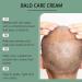 Rubu22a Bald cream scalp care cream natural antishine effect moisturizing nourishing and scalp care cream for bald head wearers 1 - Buy Online on GoSupps.com