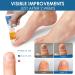 N gelr par urraMe - Effective Zeh nn gelp Treatment Pillz for Healthy Nails - 20g - International Shipping Available - Buy Online on GoSupps.com