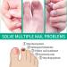 Kerassentials Extra Strength Toenail Fungus Treatment - Nail Repair Solution for Toenails & Fingernails (1oz) - Fast Relief for Discoloration & Damage - Buy Online on GoSupps.com