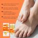  ZLHHRZJX Moisturizing and Anti-Crack Foot Cream with 60% Urea Foot Care Stick and Cream with Urea Heel Lotion Repairs Cracked Feet and Moisturizes Dry Feet (7 Pieces) - Buy Online on GoSupps.com