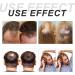 Oignon Biotine & Romarin Shampooing & Treatment Set Anti-Chute Hydratant Nourrissant R parateur Pour Tous Les Types De Cheveux (Shampooing + Revitalisant) - Buy Online on GoSupps.com