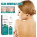 Scarremove Advanced Scar Spray - Gentle Skin Care for Acne Prone Skin - Acne & Dark Spot Remover - 1Pcs - Buy Online on GoSupps.com