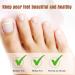 Konohan 36 Pcs Toe Wraps & Straighteners - 3 Sizes, Cushioned Bandages for Hammer Toes, Broken Toes, Crooked Toes, Trigger Finger - Buy Online on GoSupps.com