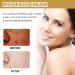 G neric Crema para Aclarar las Axilas y Partes Intimas Collagen Cream for Women Crema Para Manchas Oscuras En La Cara Para Piel Entrepierna Manchas Codos Piernas Zonas Rodillas Cuello 1pcs - Buy Online on GoSupps.com