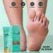 Simon&Tom Callus Remover Gel 100ml - Aloe Vera & Argan Oil - Softens Hard Skin, Repairs Cracked Heels - Paraben-Free - Nail File Included - Buy Online on GoSupps.com