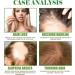Rosemary Oil for Hair - 59ml | Nourishing Hair & Scalp Care Oil | Reduce Hair Loss & Promote Healthy Growth (2PCs) - Buy Online on GoSupps.com
