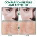 ScarRevita Advanced Repair Serum - Powerful Scar Gel for All Skin Types - Buy Online on GoSupps.com