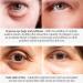 VYOFLA Magic Eye Cream - 2022 New Anti-aging Solution | Rapidly Removes Eye Bags, Wrinkles & Dark Circles in 28 Seconds | Vibrant Glamour Formula | 1PCS - Buy Online on GoSupps.com