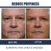 EAST MOON Men's Cool Tender Eye Cream - Anti-Wrinkle Firming & Puffiness Reducing Peptide Gel (2PCs) - Shop Internationally! - Buy Online on GoSupps.com