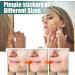 224 Star Shape Pimple Acne Hydrocolloid Patches - Absorbing Cover for Blemishes, Whiteheads, and Zits - Buy Online on GoSupps.com
