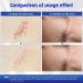 Scar Cream Silicone Gel for Old and New Scars - Advanced Formula for Keloids, Surgery, Acne - 1.5 OZ - Visible Results - All Skin Types - Buy Online on GoSupps.com