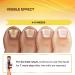 TOTCLEAR Extra Strength Nail Fungus Treatment for Toenail - Maximum Hydration for Renewed, Healthy Nails and Relief from Athlete's Foot - Buy Online on GoSupps.com