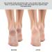 ForPro Pro Fusion Stainless Steel Coarse Double-Sided Pedi File - Blue Handle Pedicure File for Heels & Feet - 8.25 - Buy Online on GoSupps.com