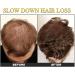 Hair Thickening Shampoing Hair Strengthening Oil Scalp Moisturizer women Dense Hair Growth Repairing Oil for Hair Loss Damaged Hair Repairing Oil - Buy Online on GoSupps.com