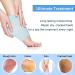 Moisturizing Gel Socks for Dry Cracked Heels - Foot Spa Treatment for Softening and Hydrating Heels (1 Pair) - Buy Online on GoSupps.com