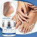 Urea Cream 45% Urea Foot Cream Foot Cream for Cracked Heels and Dry Skin Athletes Foot Cream Cracked Heel Repair Cream Cracked Heel Repair Cream for Feet and Hand - Buy Online on GoSupps.com