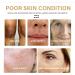 Turmeric Face Serums Oil Turmeric Serum Bright Skin Dark Spot Corrector Turmeric Essence Oil for Moisturizing Anti Aging Serum for Face Anti-aging Facial Bright Skin Oil 30ML - Buy Online on GoSupps.com