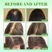 Rosemary Oil for Hair Growth - 59 ml Hair Care Oil (2 Pack) | Reduce Hair Loss & Nourish Scalp with Rosemary Mint Oil - Buy Online on GoSupps.com