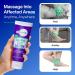 Epsom-It Calming Foot Lotion - Soothing Magnesium Cream for Sore Feet Ankles & Cracked Heels | 3.5oz Topical Epsom Salt Relief - Buy Online on GoSupps.com