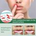 Naroote Herbal Extract Canker Sore Relief Spray for Daily Oral Care 20ml - Buy Online on GoSupps.com