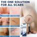 RedOceansM Scar gel scar removal cream scar care gel scar repair cream stretch mark creams remover 20 g scar ointment after use natural scar gel reduces the visibility of - Buy Online on GoSupps.com