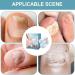 Acunny Nail Cleaning Device Nail Cleaning Device Nail Cleaner Conditioner for Damaged and Discolored Nails | Home Use Nail Cleaning Lamp Device - Buy Online on GoSupps.com