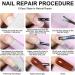  Zestivra Nail Fixation Gel Set Clear Glue for Nail Repairs Repairing Cracked Nails Repairing Split Tips Nail Glue Repair | Gel Set - Buy Online on GoSupps.com
