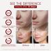 Moisturizer Face Cream with Hyaluronic Acid, 95% Snail Secretion Filtrate Anti Wrinkle Cream for Skin Repair & Tighten, Repair Damage, Promote Regeneration, Intensive Moisturizing, 4.586oz (Snail_2) - Buy Online on GoSupps.com