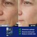 6 in 1 Face Cream for Men Anti Aging Men s Moisturizer with Collagen Hyaluronic Acid and Shea Butter Daily Skin Care Reduce the Look of Eye Bags Dark Circles and Puffiness 1.76 fl oz (1) - Buy Online on GoSupps.com