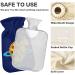 Buy MIT TIVE Transparent Heat Bottle 1L | NAANLE Pizza Planet for Pain Relief & Warmth | Ideal for Bed & Hand Warmers - Fast International Shipping - Buy Online on GoSupps.com