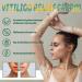  Wootapson 2PC Vitiligo Care Cream Skin Therapy Cream Lotion for vitiligo moisturizing and nourishing helps improve skin pigmentation and uneven tone suitable for all skin types - Buy Online on GoSupps.com