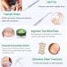 Ingrown Toenail Treatment Tool Kit Professional Ingrown Toenail Removal Kit with File and Lifter Toenail Corrector Patch and Toe Protectors Toe Nail Clippers for Thick Nail Correction Pain Relief - Buy Online on GoSupps.com