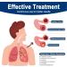 Lung Exerciser Device for Stronger Lungs | OPEP Therapy for Mucus Relief & Lung Expansion - Buy Online on GoSupps.com