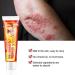  MagiSel Anti-itch ointment skin cream soothing skin cream for itching and psoriasis natural care formula cares for and soothes the skin suitable for skincare - Buy Online on GoSupps.com