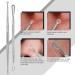 Blackhead Remover Tool JOLIFILE Upgraded 9 Pcs Pimple Popper Tool Kit Extractor Tools with Tweezers Removal Comedone Whitehead Set Large Size-Silver - Buy Online on GoSupps.com