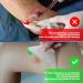 Hydrocolloid Dressings 5cm x 5cm - Extra Thin Waterproof Wound Care for Ulcers Burns & Blisters - 10 Pack (0.3mm) - Buy Online on GoSupps.com