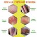 Buy Drawing Salve Cream for Boils & Cyst Removal | 2 Fl Oz (Pack of 8) - Itch Relief for Ingrown Hairs Splinters Bug Bites & More - Buy Online on GoSupps.com