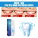 Frosty Neptune Teeth Whitening Essence Pen - Remove Stains & Reduce Yellowing (3PCs) - International Shipping Available - Buy Online on GoSupps.com